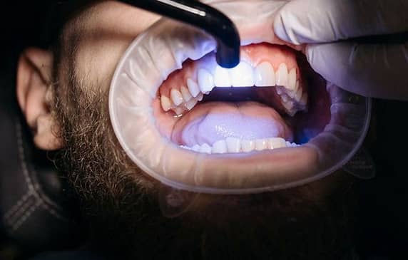 Slider image (7) Perio & Implants Tijuana